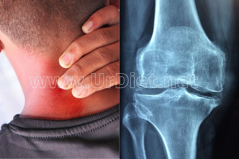 علاج الام الركبة والمفاصل